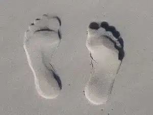 טביעת רגליים על חול: עדויות מטופלים: טיפול בדרבן בכפות הרגליים