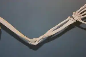 עצמות המרפק טיפול במרפק טניס